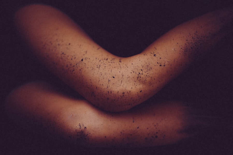 Somatic Healing