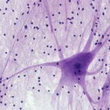 Photo Nervous System