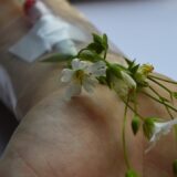 Photo Healing Trauma